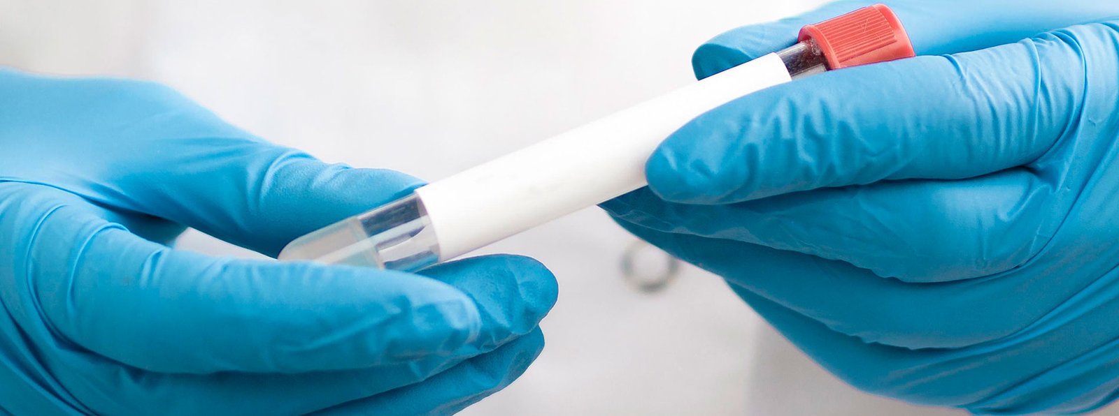 Cribado y prevención: las claves para detectar el cáncer a tiempo