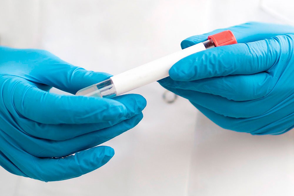 Cribado y prevención: las claves para detectar el cáncer a tiempo